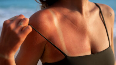 solski izlet na otok sylt se je koncal v bolnisnici in na sodiscu 686fffbba5987 1752170427