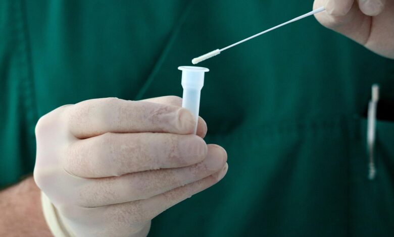 Več kot 90 odstotkov atletinj že opravilo genski test: Pojasnila predsednika Svetovne atletike 1 genetic test