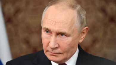 putinova otecena dlan sproza nova ugibanja o njegovem zdravju foto 69135d98400b5 1762876824