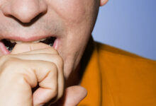 semic med posredovanjem ugriznil policista 691e13dd8e6e6 1763578845