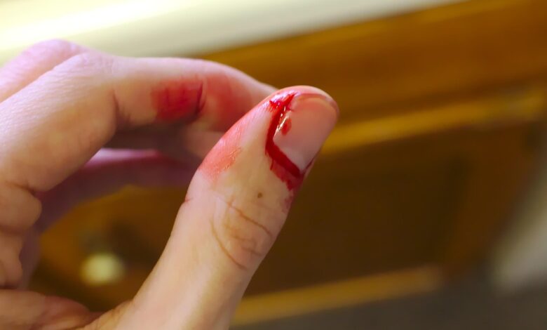 Groza blizu Gradca: Mati osumljena umora 11-letnega sina 1 groza blizu gradca mati osumljena umora 11 letnega sina 697dc4be5d724 1769850046