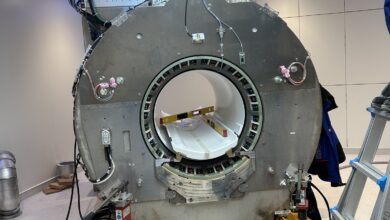 ukc ljubljana do naprednejse diagnostike z novim 3t mr aparatom 696bb21180599 1768665617