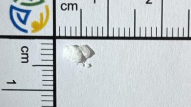 sokantno odkritje ljubljanski kokain vsebuje zdravilo za gliste 69a05203356bd 1772114435