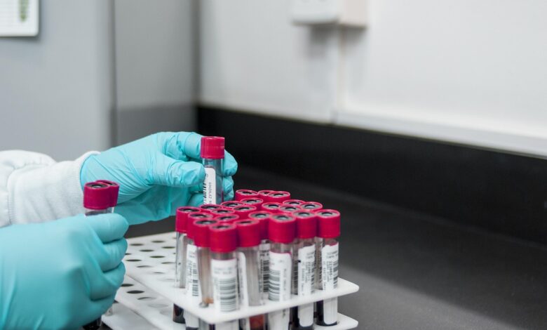 Starši zahtevajo vračilo vzorcev: JAZMP pod pritiskom izvršitve 1 starsi zahtevajo vracilo vzorcev jazmp pod pritiskom izvrsitve 69e0c1534c1d2 1776337235